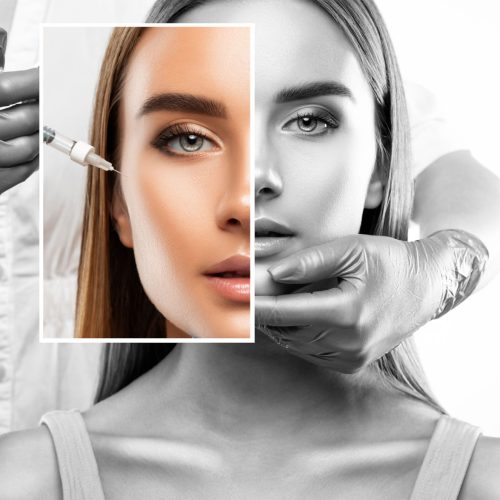 Cosmetologist does injections for lips augmentation and anti wrinkle in the nasolabial folds of a beautiful woman. Women's cosmetology in the beauty salon.